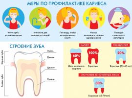 Infograf